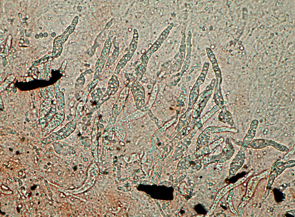 Gloeocystidiellum porosum